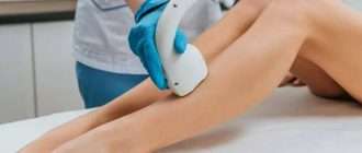 Лазерная эпиляция в Красноярске: как выбрать лучшую клинику и подготовиться к процедуре