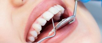 Комплексное лечение зубов: от диагностики до восстановления улыбки